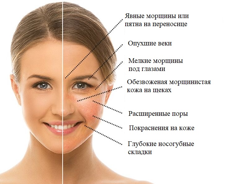 Как убрать покраснение и отёчность лица после приёма алкоголя?
